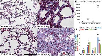 Histopathological Correlations between Mediastinal Fat-Associated Lymphoid Clusters and the Development of Lung Inflammation and Fibrosis following Bleomycin Administration in Mice